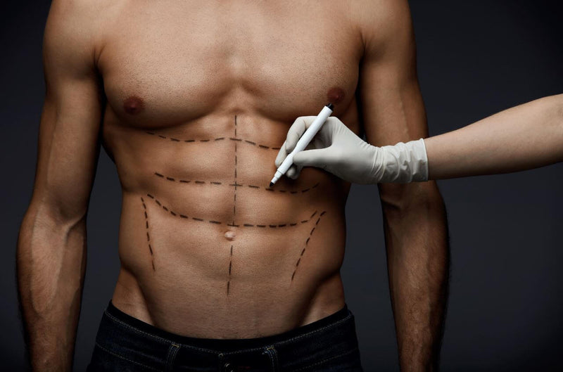 Gut geformte Hüften und Abdomen - Bauchstraffung