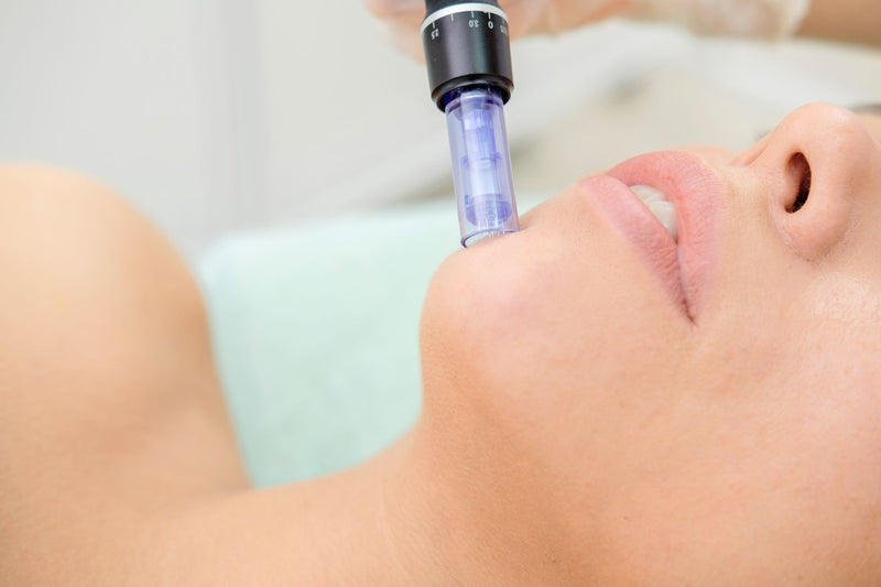 Microneedling für die Gesichtshaut: Der Schlüssel zu strahlender Haut