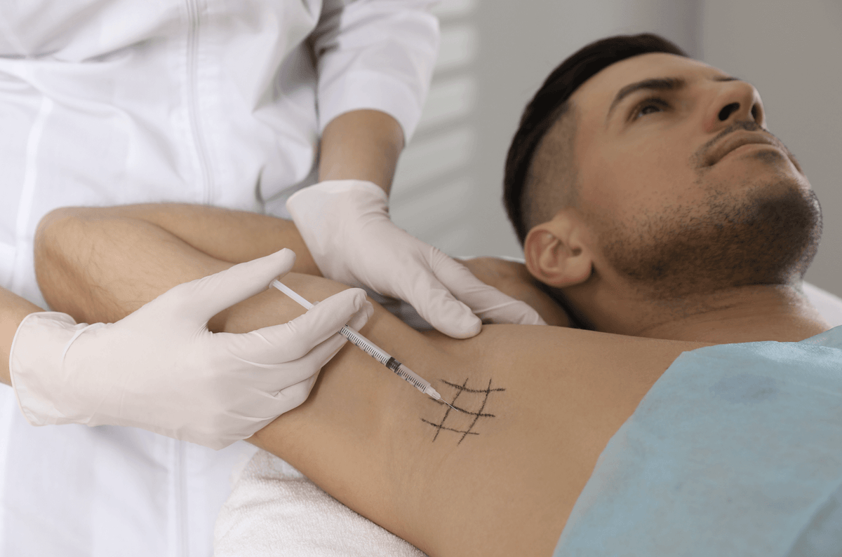 Botox für die Achseln: der sanfte Weg, um lästiges Schwitzen zu beseitigen