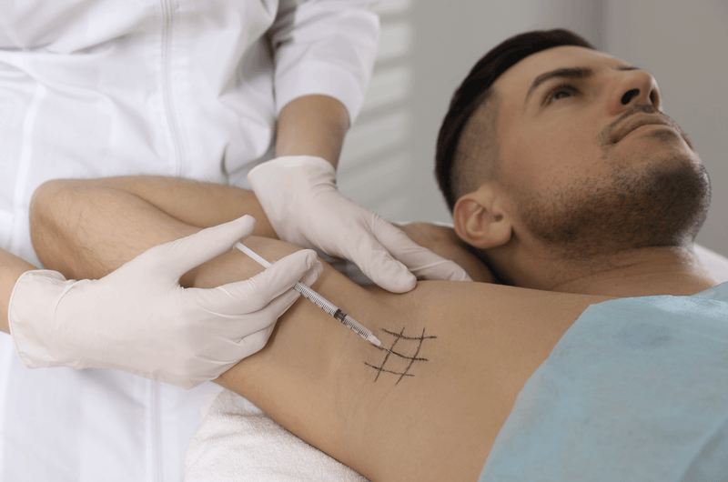 Botox für die Achseln: der sanfte Weg, um lästiges Schwitzen zu beseitigen