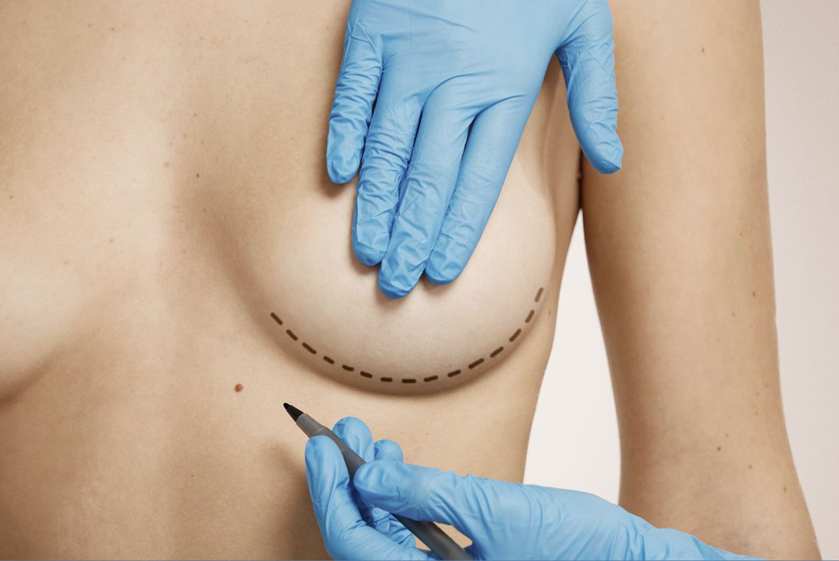 Schönheitschirurgie im Sommer: welche Eingriffe werden empfohlen?
