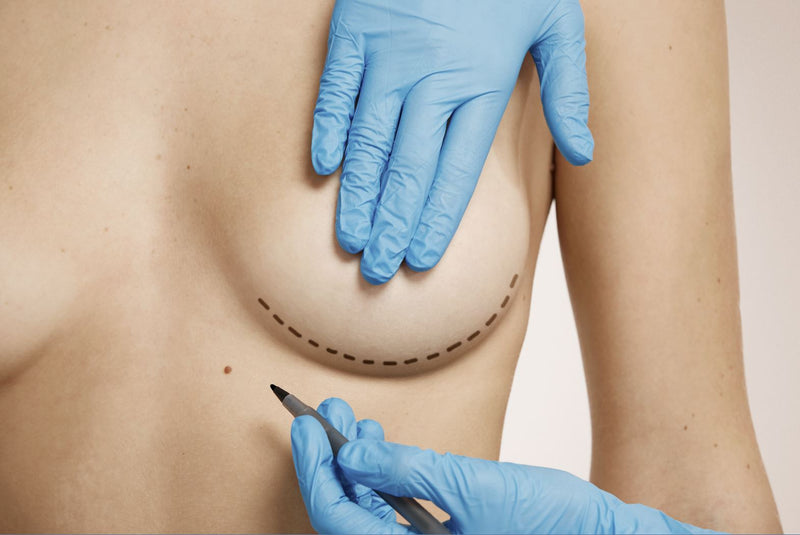 Schönheitschirurgie im Sommer: welche Eingriffe werden empfohlen?